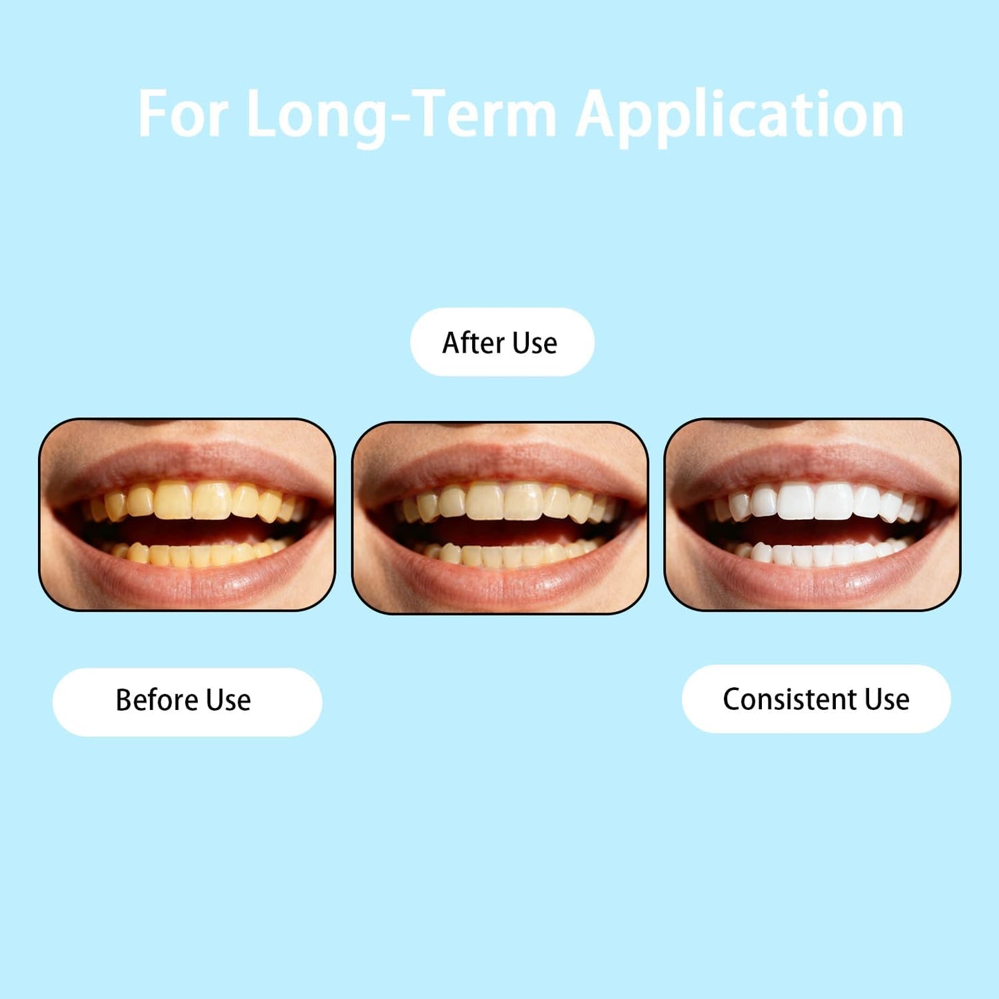 Dental Truerelief™